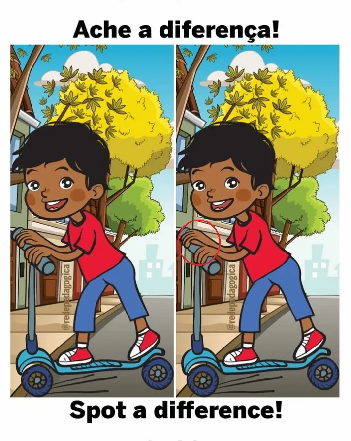 Ache a Diferença: O Menino de Patins